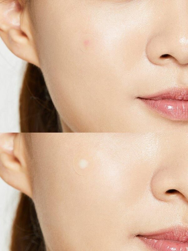 ⁦Acne Pimple Master Patchلصقات الحب cosrx 24 patches⁩ - الصورة ⁦4⁩