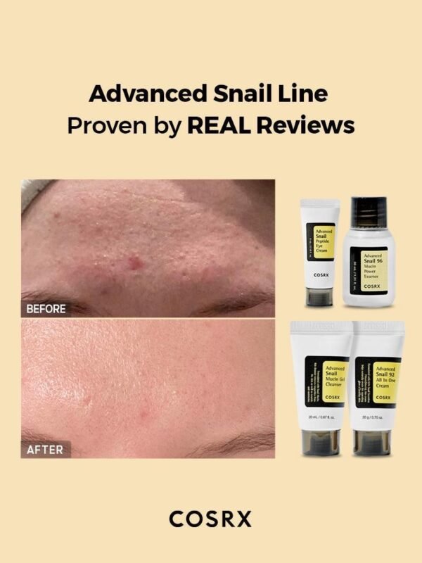 ⁦All about snail kit مجموعة العناية بخلاصة الحلزون⁩ - الصورة ⁦3⁩