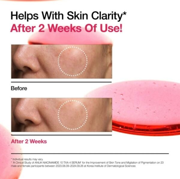 ⁦Anua Niacinamide 10% + TXA 4% Dark Spot Correcting serum 30ml⁩ - الصورة ⁦6⁩