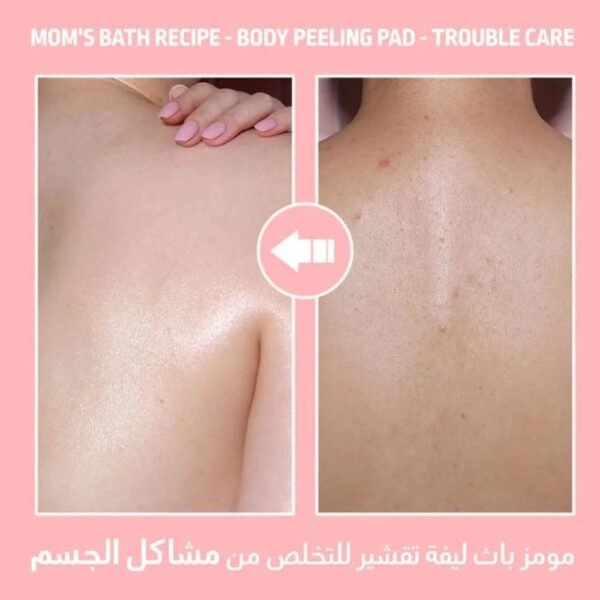 ⁦Mom's Bath Recipe Body Peeling Pad Strong⁩ - الصورة ⁦3⁩