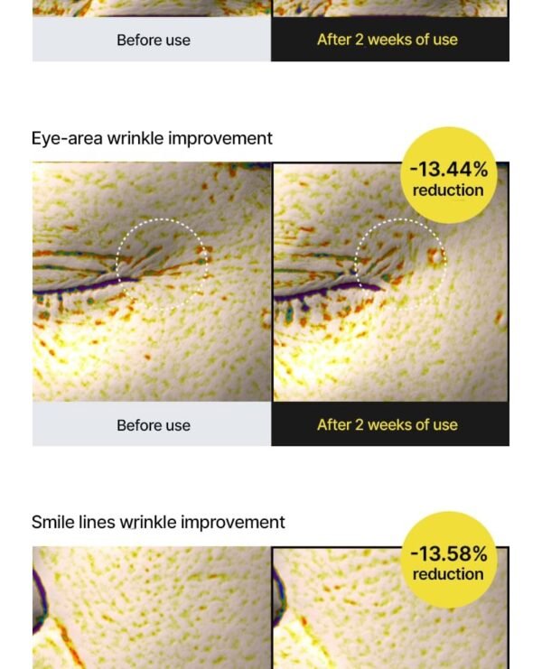 ⁦celimax - The Vita-A Retinol Shot Tightening Serum
سيليماكس سيروم الشد بالرتنول⁩ - الصورة ⁦3⁩