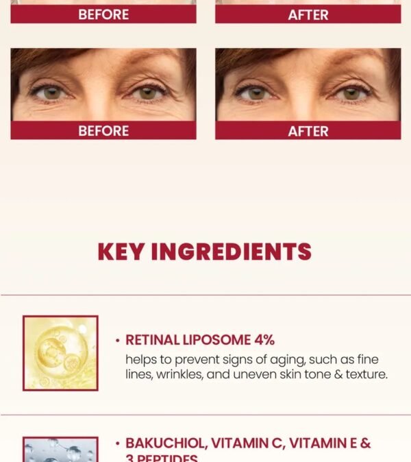 ⁦KSECRET - SEOUL 1988 Eye Cream : Retinal Liposome 4% + Fermented Bean⁩ - الصورة ⁦6⁩