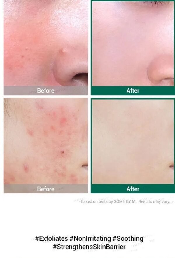 ⁦Some by mi serum سيروم المعجزة 
50ml⁩ - الصورة ⁦7⁩