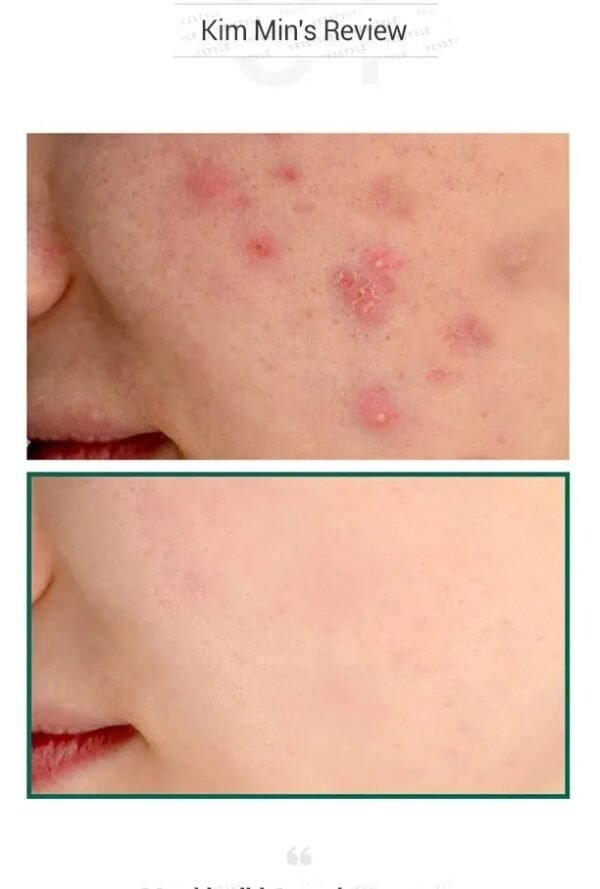 ⁦Some by mi serum سيروم المعجزة 
50ml⁩ - الصورة ⁦5⁩