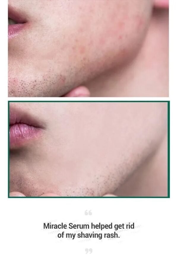⁦Some by mi serum سيروم المعجزة 
50ml⁩ - الصورة ⁦4⁩